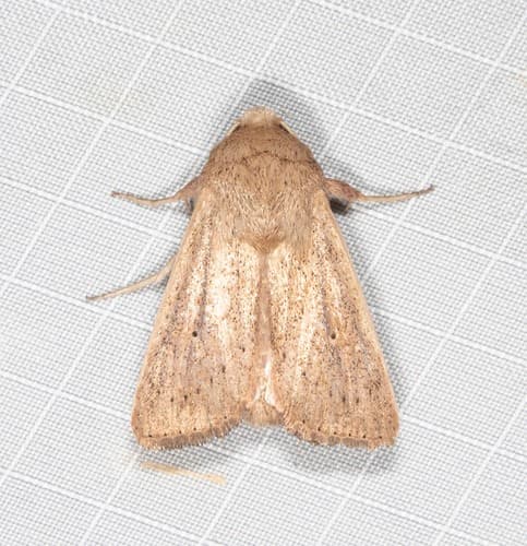 Abdominal Wainscot